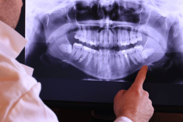 Best Emergency Gum Treatment in Leakesville, MS