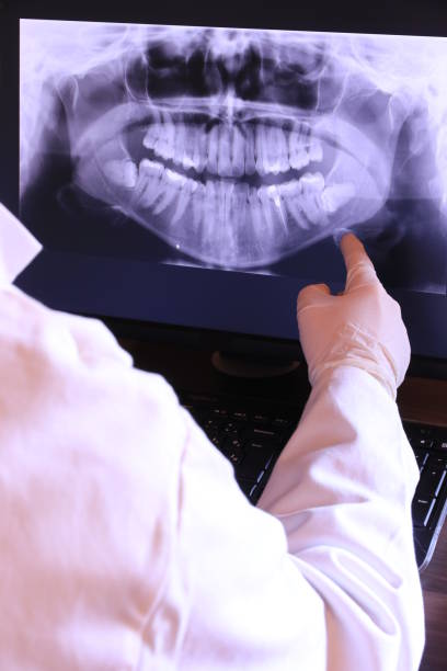Best Emergency Root Canal Treatment in Leakesville, MS